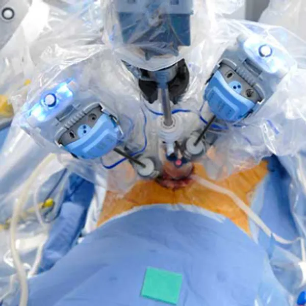 Robotic, Laparoscopic Uro-Surgeon