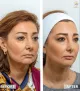 Dubai Cosmetic Surgery Clinic