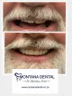 Montana Dental