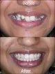 Dr. Bothra's SMILE Designing Center