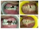 Dr. Bothra's SMILE Designing Center