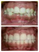 Dr. Bothra's SMILE Designing Center