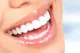 Sunnyvale Family and Cosmetic Dentistry