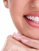 Full Face Orthodontics