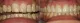 Auburn Smiles