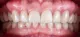 Marconi Dental Aesthetics - Pasadena, TX