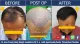 Perfection Hair Transplant Clinic