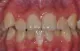 Dunbar Family Dental