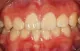 Dunbar Family Dental