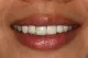 Dunbar Family Dental