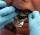 Impressions Dental