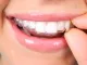 Pure Orthodontics