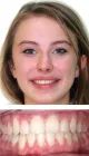 Pure Orthodontics