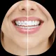 Pure Orthodontics