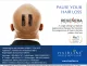 Hair Loss Treatment in Bangalore - Hairline International