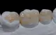 Balmore Dental Care