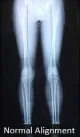 Sai Institute Of Arthroscopy And Sports Injury