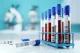 Blood testing - Dimokritos S.A.